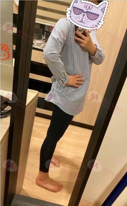 剖腹产塑身衣，产后21天可量身，迫不及待的塑身衣减肥计画，维娜斯剖腹产塑