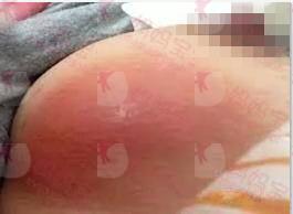 6种产妇产后常见疾病，你都知道吗？