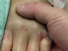 妇产名医为患癌妻开刀泪洒手术台 3症状揭卵巢癌晚期