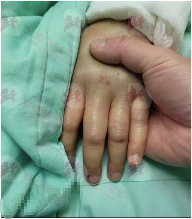 妇产名医为患癌妻开刀泪洒手术台 3症状揭卵巢癌晚期