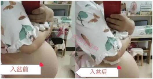 生产前，除了见红，破水，这几个“临产”症状你发现了吗？