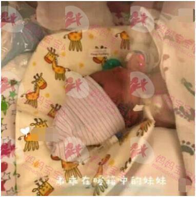 35周羊水早破，子痫并发症，早产双胞胎姐姐4.2斤，妹妹4斤