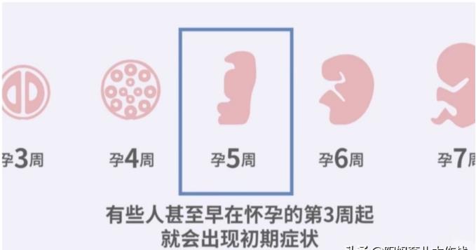 怀孕初期症状有哪些:怀孕初期不只会孕吐频尿!怀孕初期可能遇到的「5道关