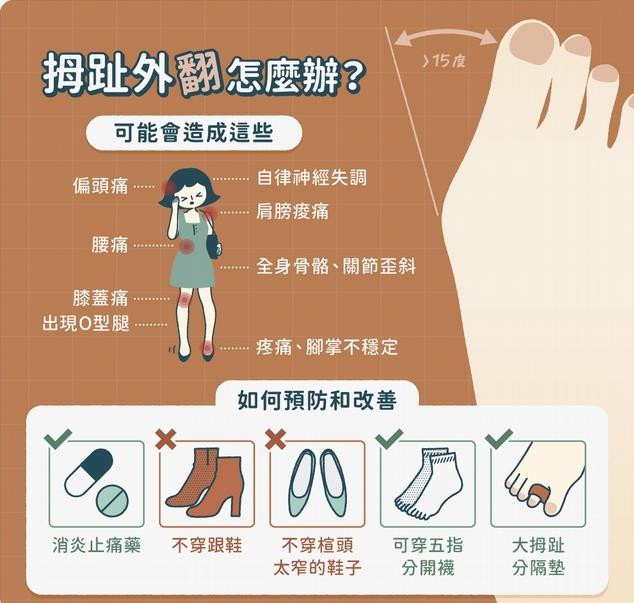 肩膀酸、偏头痛⋯竟是因「拇趾外翻」造成？医教「1招」自我检测