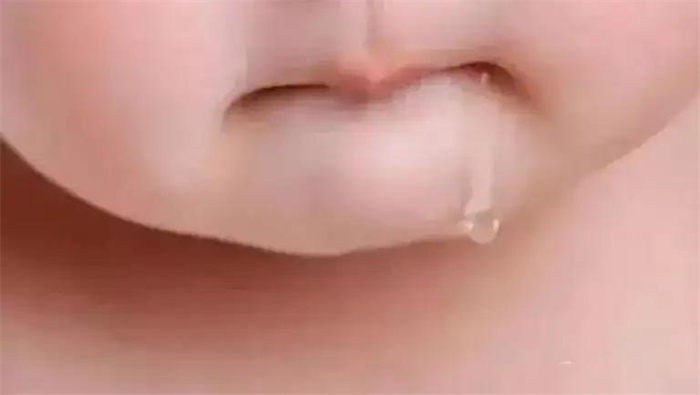 宝宝爱流口水 宝宝3个月流口水正常吗