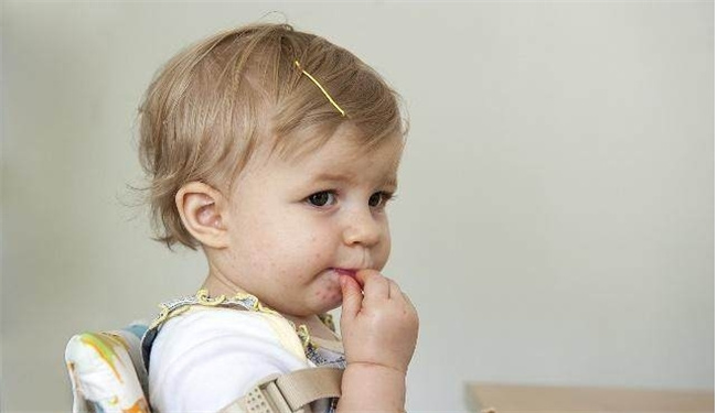 学会这几招 手足口病再也不可怕