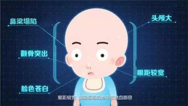 小儿地中海贫血应该怎样预防