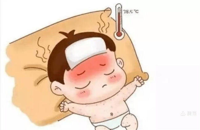 小儿发烧39度 家长应该怎么办（物理降温，服退烧药）