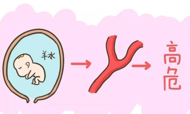 分娩有哪些并发症（羊水栓塞、大出血等）