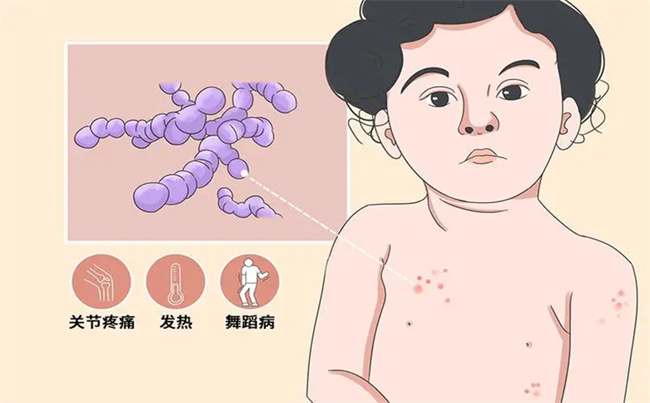 儿童风湿热的主要症状有哪些？该如何治疗？（咽喉肿痛、关节炎等）