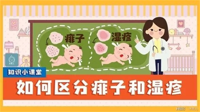 宝宝身上的痱子治疗（好发部位）