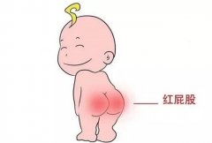 什么原因造成的婴儿红屁股