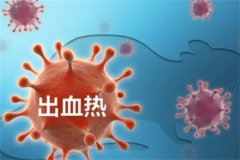 出血热的症状有哪些