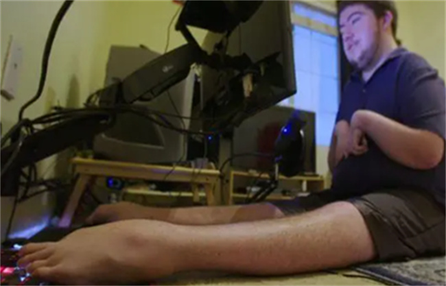 关节挛缩是什么原因引起的