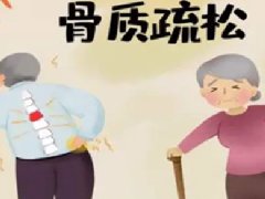 治疗骨质疏松最佳方法