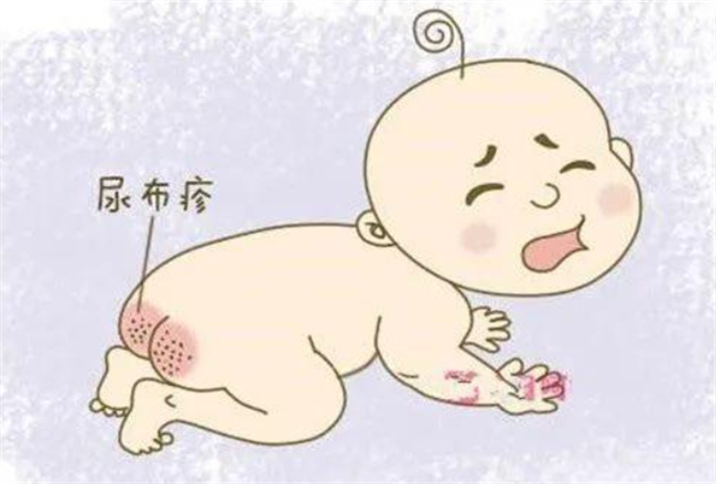 宝宝红屁屁是怎么回事
