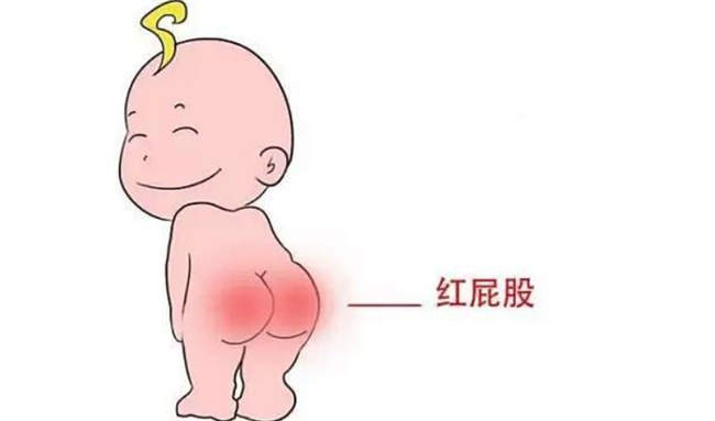 宝宝红屁屁是怎么回事