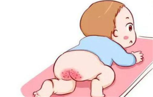 宝宝红屁屁是怎么回事