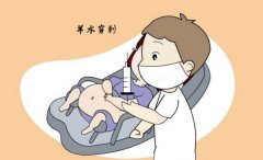 探秘羊水穿刺CNV：产前诊断的科学之窗
