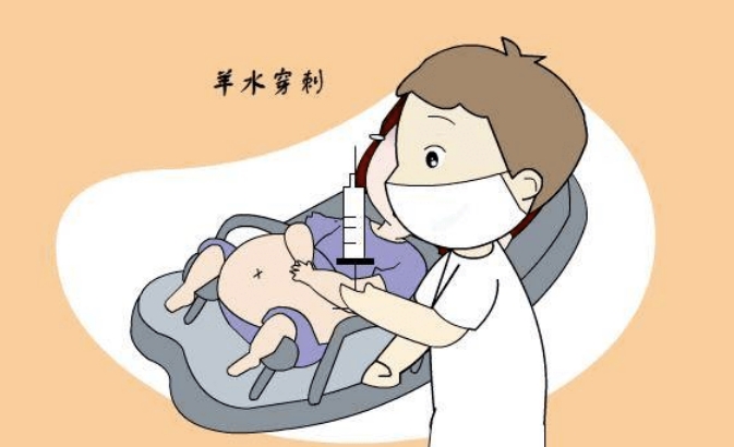 探秘羊水穿刺CNV：产前诊断的科学之窗