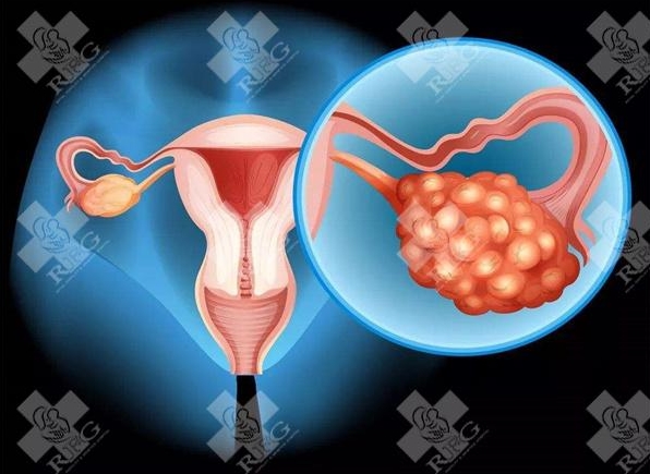 提高生育机会：促排卵的科学方法