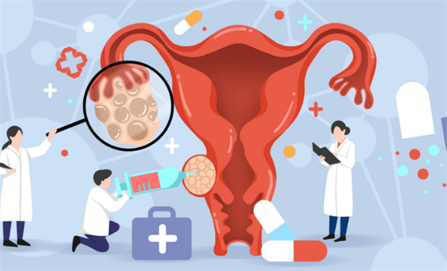 卵巢恶性肿瘤治疗方法详解