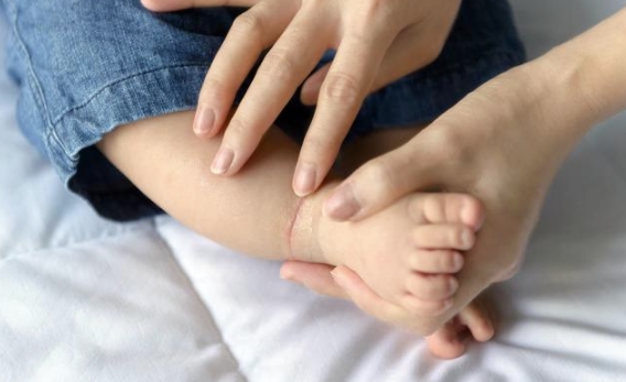 宝宝发烧时可否泡脚？专家详解应对策略