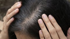 保护秀发健康，掉发不再困扰，从饮食入手！