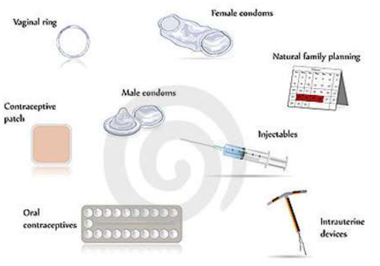 避孕方法大揭秘！十种避孕方式及成功率详解