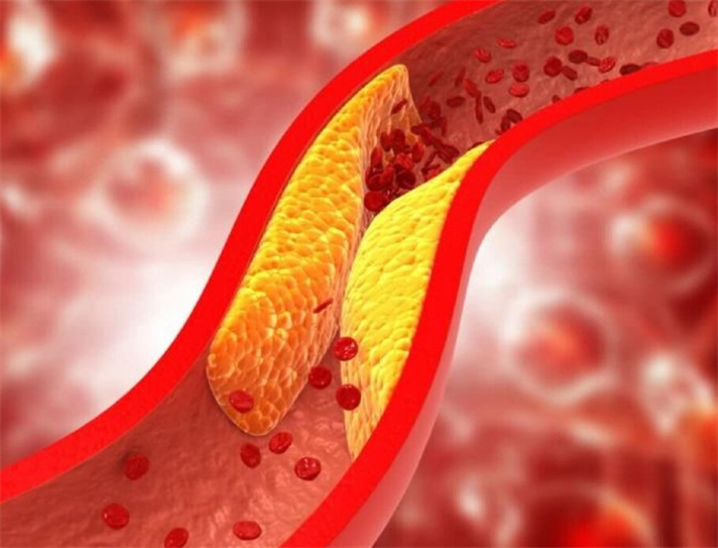 摆脱全身经络不通，迎接健康生活的秘诀