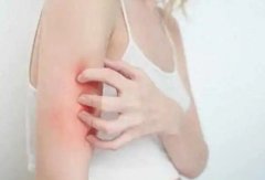 湿疹困扰新生儿？专业护理方法助您轻松解决！