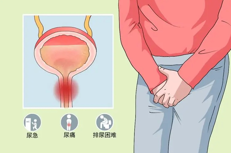 深度解析非淋菌性尿道炎：潜伏期、症状及处理方法