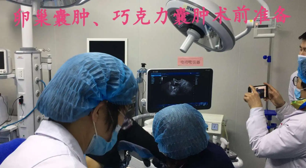 巧克力囊肿运动改善可能吗？注意！5大巧克力囊肿症状
