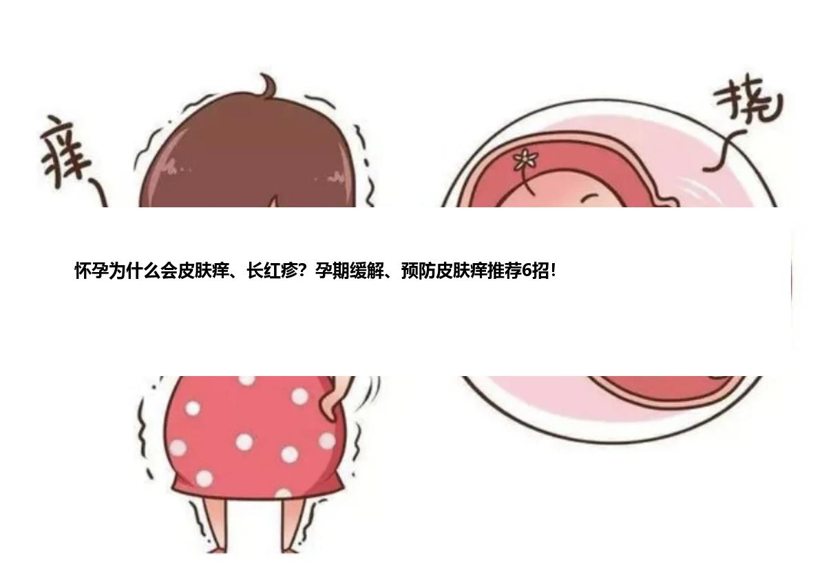 怀孕为什么会皮肤痒、长红疹？孕期缓解、预防皮肤痒推荐6招！