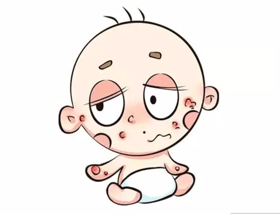 H千万别乱吃婴儿营养品，轻症也可能导致休克死亡！