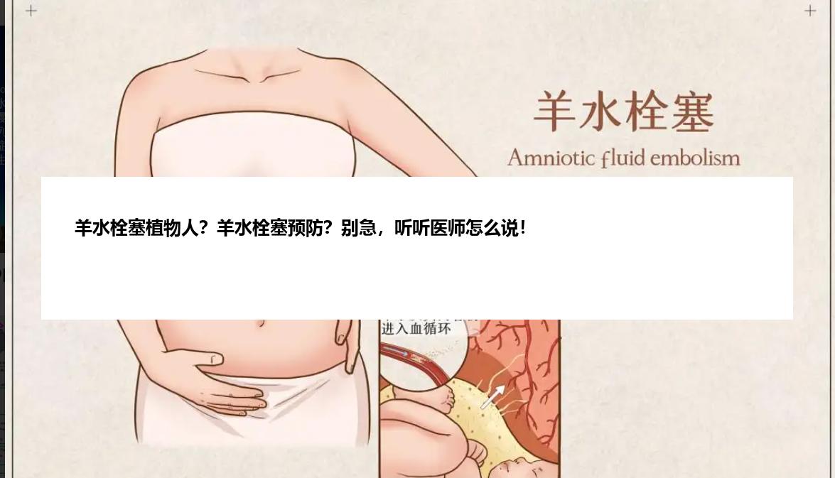 羊水栓塞植物人？羊水栓塞预防？别急，听听医师怎么说！