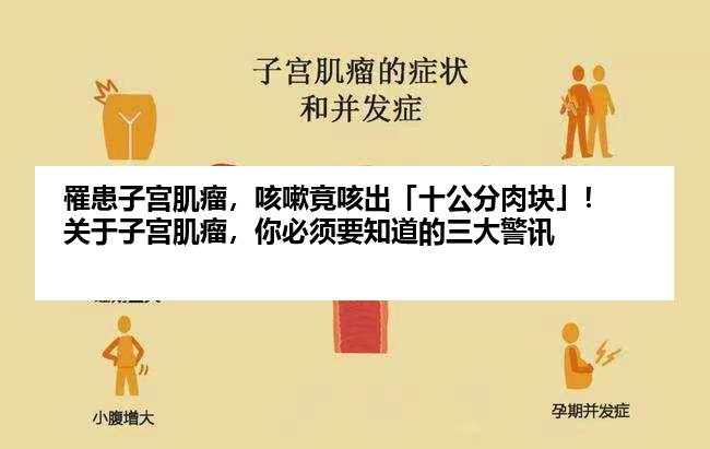 罹患子宫肌瘤，咳嗽竟咳出「十公分肉块」！关于子宫肌瘤，你必须要知道的三大警讯