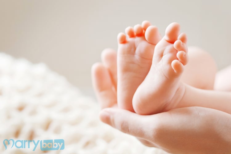 治疗儿童的Clubfoot (马脚) 必须尽快!