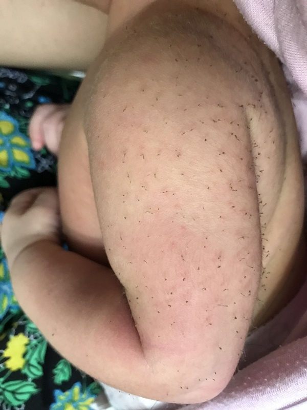 民间如何治疗婴儿的头发对儿童真的安全吗?