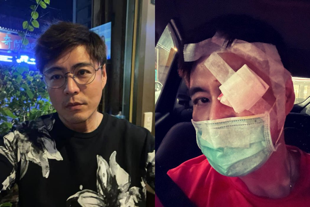 刘至翰「脸包染血纱布照」揭真相　吓坏一票网友