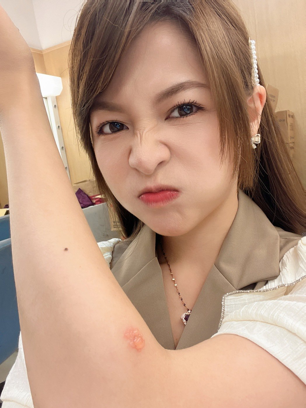 女优一夜情曝光压力大到长皮蛇　内疚泪崩眼肿如面龟