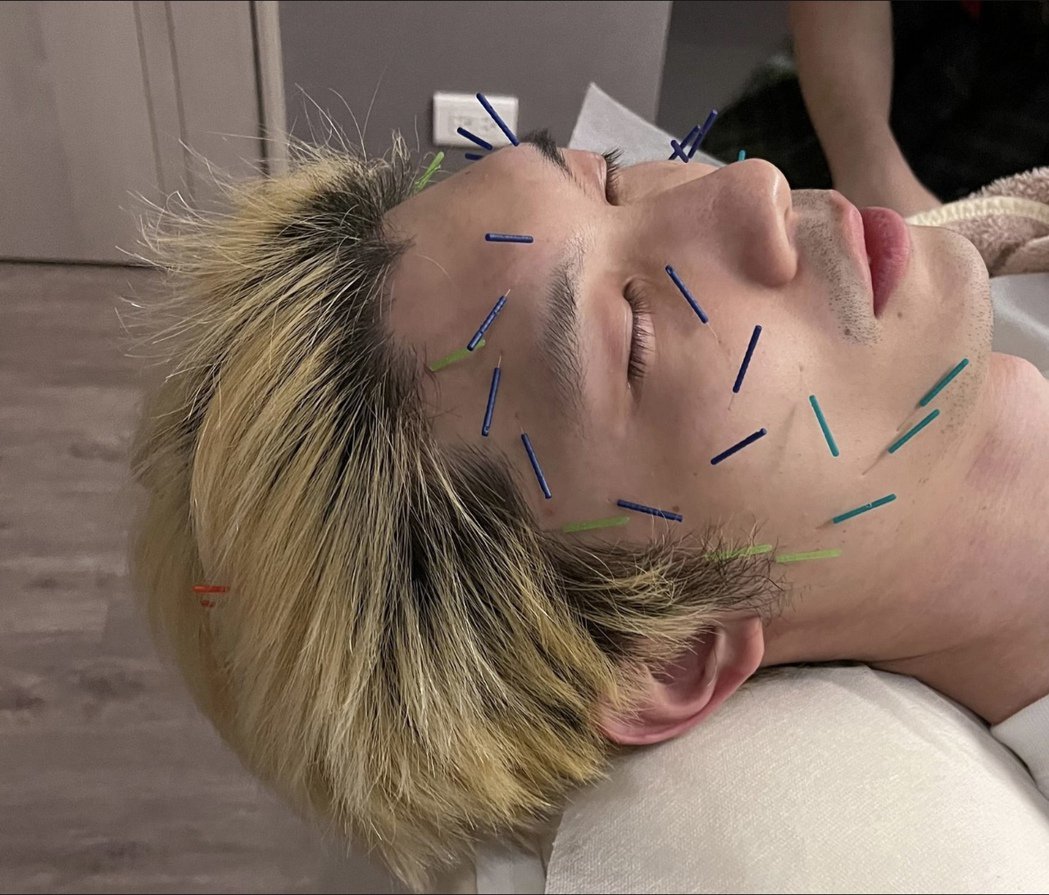 DJ为吸睛放大绝！直播针灸、蜜蜡除毛 成果曝光被笑爆