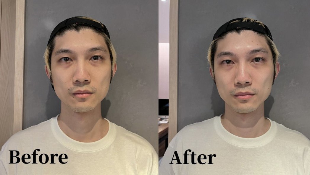 DJ为吸睛放大绝！直播针灸、蜜蜡除毛 成果曝光被笑爆