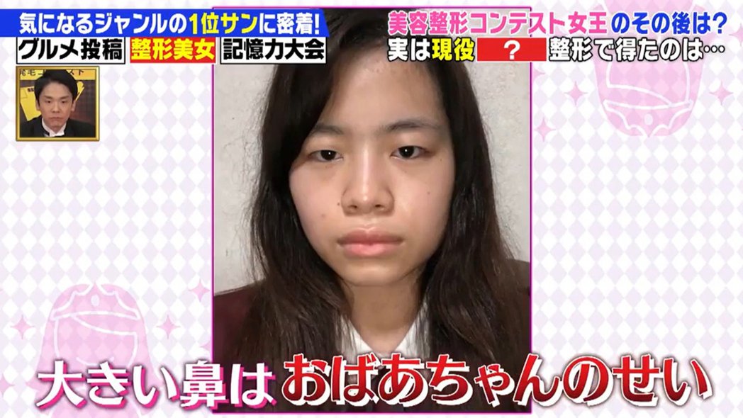 23岁女偶像「太丑没粉丝」　怒砸188万整形