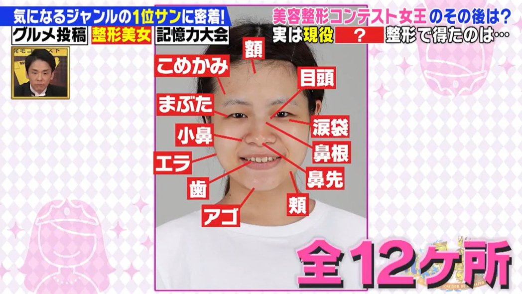 23岁女偶像「太丑没粉丝」　怒砸188万整形