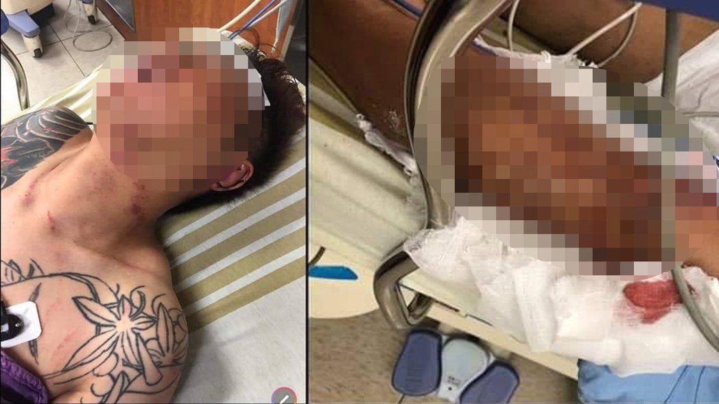 邀宪哥火葬场吃肉粽、躺棺材暴红  吴小哲遭人断手脚嫌犯被逮