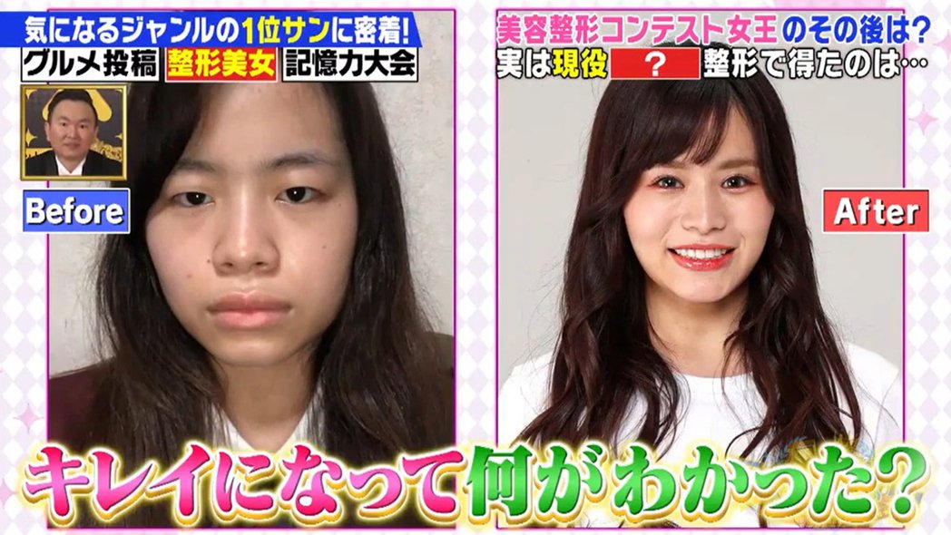 23岁女偶像「太丑没粉丝」　怒砸188万整形