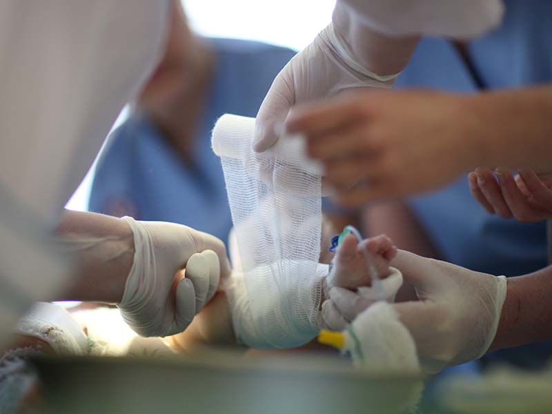 小鼠蹊疝气是小儿外科手术的大宗，尿道下裂治疗有难度