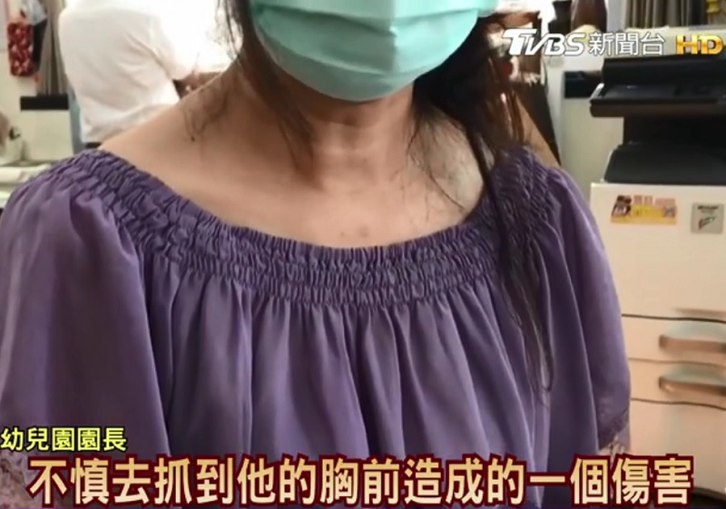 家长控不当管教导致5岁男童左胸瘀青,幼儿园秀监控喊冤