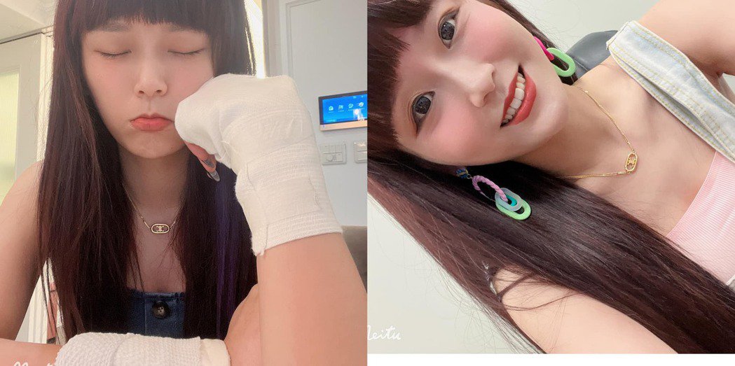 丢丢妹直播料理翻锅滚烫热油喷出手部烫伤惊呼「我用命在拼」